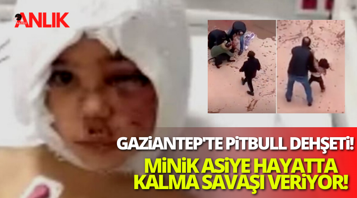 Gaziantep’te Pitbull dehşeti! Minik Asiye hayatta kalma savaşı veriyor!