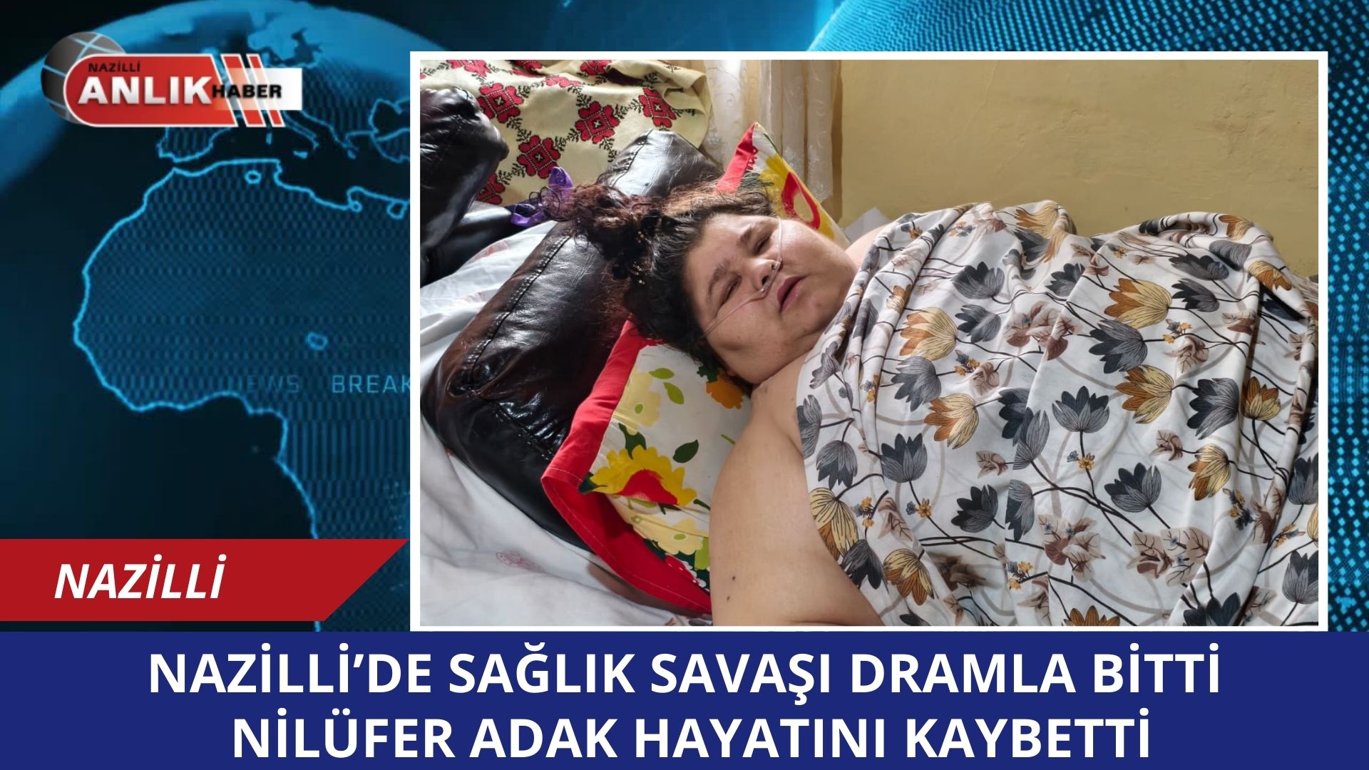 Nazilli’ye bağlı Güzelköy Mahallesi’nde fil hastalığı (lenfödem) nedeniyle 350 kiloya